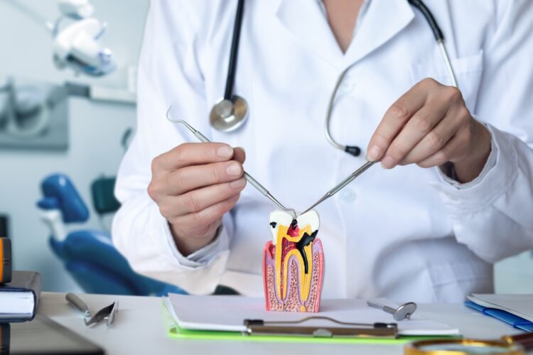 Root canal vs. dental implant