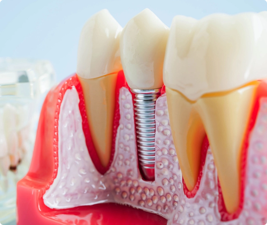 Dental illustration