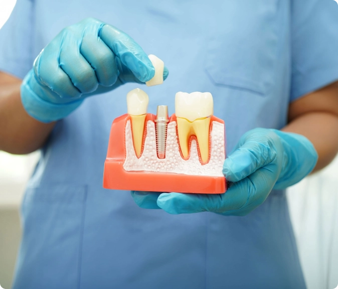 Woman dental clinic holding prototype