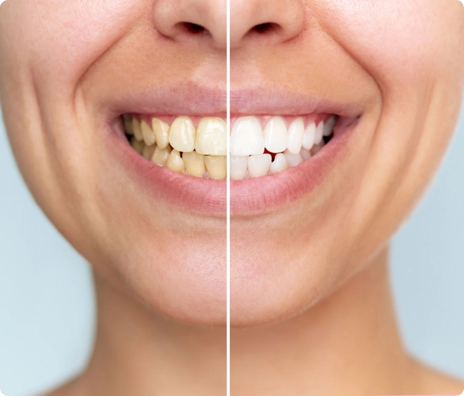 Woman smiling dental clinic calgary