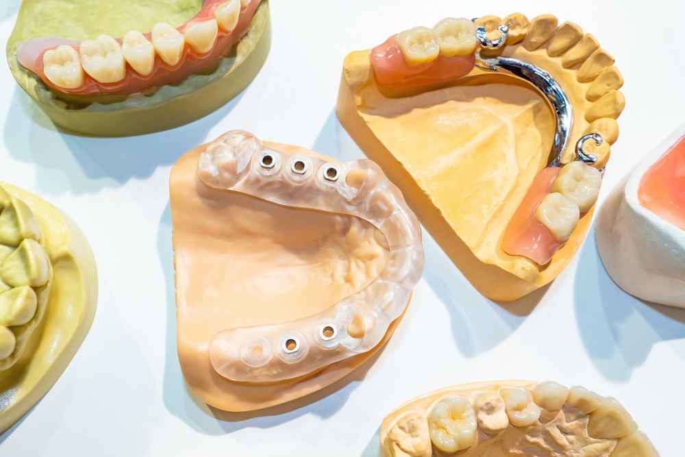 Types of dental implants